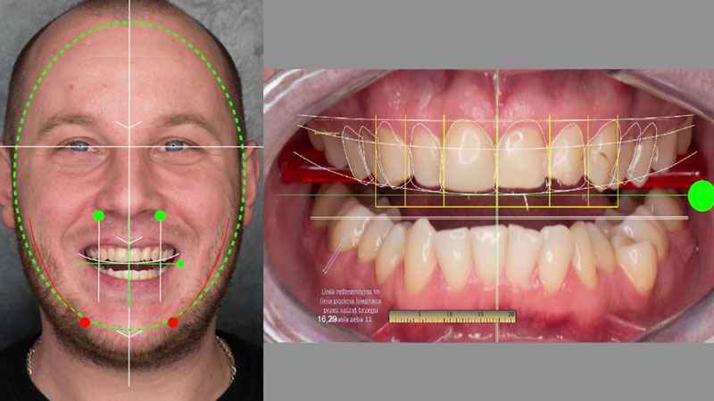 طراحی لبخند دیجیتال به کمک تجهیزات مدرن