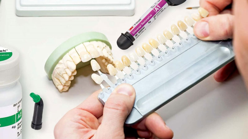 بررسی نحوه ساخت دندان در لابراتوار دندانپزشکی