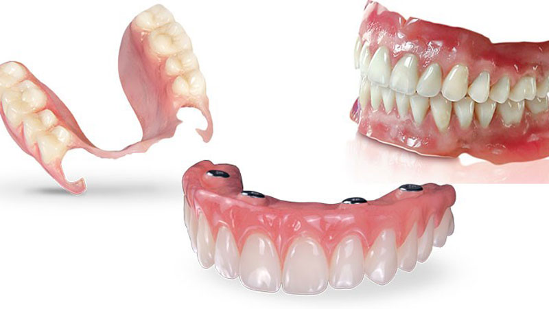 راهنمای انتخاب بهترین فعالیت‌های لابراتواری برای زیبایی دندان