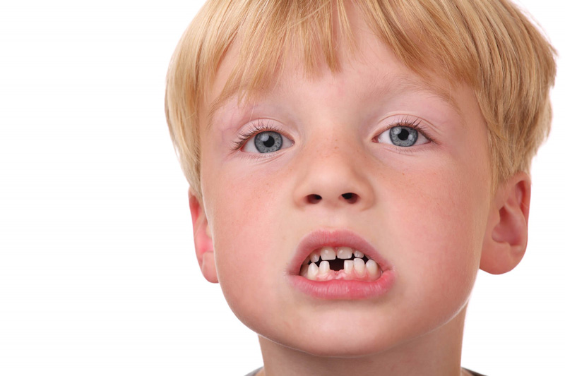 رشد صحیح دندان دائمی اطفال و معاینه دندان‌های اصلی در زمان رویش