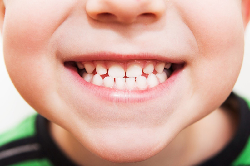 تاثیر مراجعه به دندانپزشک اطفال در رشد مناسب و منظم دندان اطفال